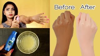 Simple Full Body Whitening Formula Easy amp 100 Effective  Rabia Skincare [upl. by Happ]