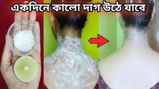 ১ দিনে  গলা ও ঘাড়ের জেদী কালো দাগ দূর হবেgola o gharer kalo dag dur korar upay Neck Whitening [upl. by Atnuahc]