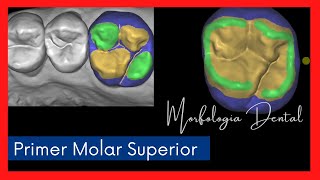 Primer Molar Superior MORFOLOGIA DENTAL💥 [upl. by Adok943]