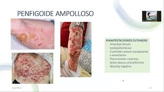 URGENCIAS EN DERMATOLOGIA I [upl. by Allin]