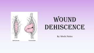 Wound dehiscence  risk factors clinical features investigation management prevention [upl. by Nolur]