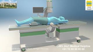 Extracorporeal Shock Wave Lithotripsy ESWL – CIMS Hospital [upl. by Budge]