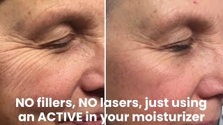 NO fillers NO lasers just using an “active” in your moisturizer 🥰 [upl. by Kahn]