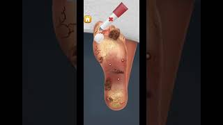 Operation of leg game 😱  mobile game ytshorts shorts viralvideo shortsvideo football game [upl. by Leviram480]