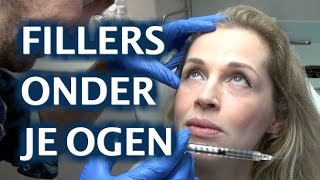 FILLERS onder je ogen  FURROWNL [upl. by Limaj]