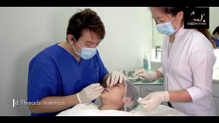 Dr Israr Wong  Nose Thread Lift 鼻子雕线 [upl. by Yanel]