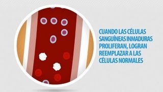 Informacion de la Leucemia [upl. by Ebeneser766]