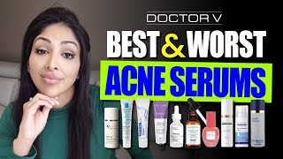 BEST amp WORST ACNE SERUMS [upl. by Teiluj585]