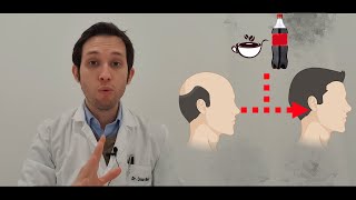 Doctor te explica si la cafeína ayuda a la calvicie [upl. by Mahala]