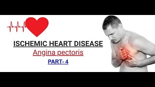 Ischemic Heart Disease  part4  Classical presentation of Angina pectoris  HINDI [upl. by Leugim]