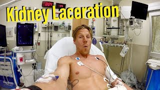 IM INTERNALLY BLEEDING amp LACERATED my KIDNEY STAGE 4 [upl. by Becker]