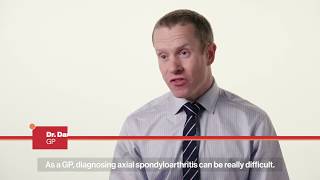 Ankylosing Spondylitis axial spondyloarthritis AS Getting your diagnosis [upl. by Airotkciv419]