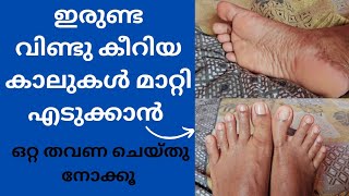 Pedicure at home  Malayalam [upl. by Yvan]