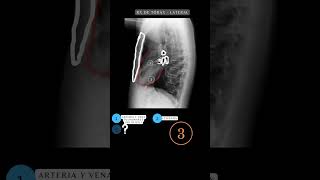 Radiografía de Tórax PA y Lateral  Anatomía de Tórax radiografía anatomía medicina shorts [upl. by Bertine]