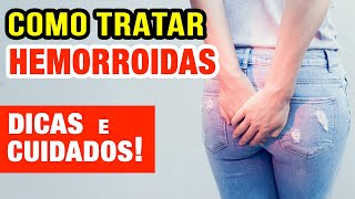 Como Tratar Hemorroidas Sem Cirurgia  100 NATURAL [upl. by Gearhart]