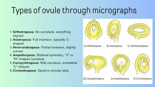 types of ovule  Bsc [upl. by Ysset]