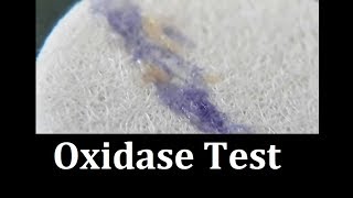 Oxidase test Protocol [upl. by Ettenahc350]