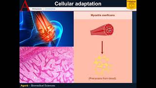 Cellular Pathology  Metaplasia [upl. by Nomsed]