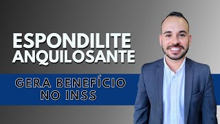 ESPONDILITE ANQUILOSANTE gera direito a benefício no INSS [upl. by Rapsac]