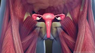 What is Intramural Uterine Fibroid Symptoms and Treatment  3D Guide [upl. by Needan]