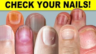 9 Things Your Nails Can Tell You About Your Health [upl. by Laufer271]