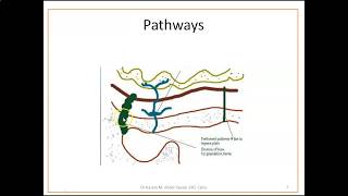 Complications of Otitis Media  1 Mastoiditis [upl. by March]