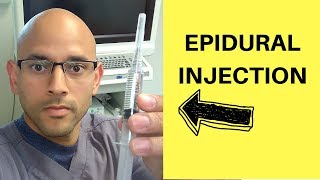 Epidural Injection for Back Pain amp Sciatica Herniated Disc [upl. by Anthony]