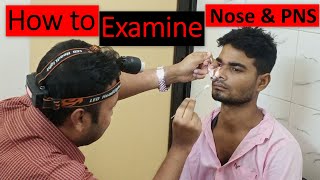 Clinical Examination of Nose amp Paranasal Sinuses Step by Step Demonstration [upl. by Nazus325]