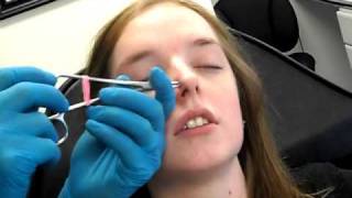 Double Nostril Piercing 2 in 1 sitting [upl. by Bary]