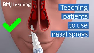 Teaching patients to use nasal sprays  BMJ Learning [upl. by Car447]