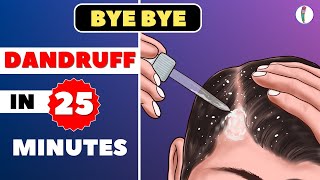 🔥1 Dandruff Treatment at Home  How to get rid of Dandruff  Dandruff Removal  Itchy scalp [upl. by Hugibert]