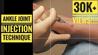 Ankle Joint Injection Aspiration Technique [upl. by Limaa]