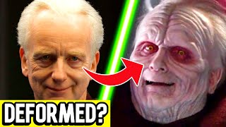 Why Did Palpatine’s Face Change shorts [upl. by Glynas]