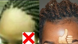 SAVE YOUR EDGES  TIPS TO KEEP YOUR EDGES INTACT WHEN BRAIDED [upl. by Anaer]