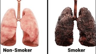 How Long Does It Take the Lungs To Heal After Quitting Smoking [upl. by Eitten538]