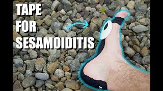 How to Tape For Sesamoiditis  Run Pain Free [upl. by Atimed423]