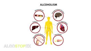 Alcostopex  Solution For Alcohol Abuse [upl. by Moitoso743]