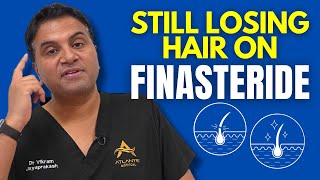 Still Losing Hair Even When On Finasteride [upl. by Kelson]