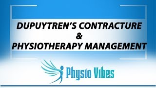 DUPUYTRENS CONTRACTURE amp PHYSIOTHERAPY MANAGEMENT [upl. by Lokin]