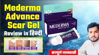 Mederma cream  mederma for acne scars  mederma advanced scar gel review Usesside effects [upl. by Akinam]