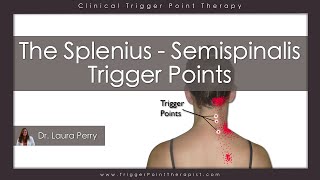 The Splenius and Semispinalis Trigger Points [upl. by Robina280]