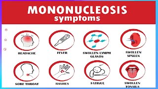 👀Mononucleosis Kissing Disease👄 Symptoms and Treatment🩺Many people are exposed to EBV as kids🔴 [upl. by Maury]