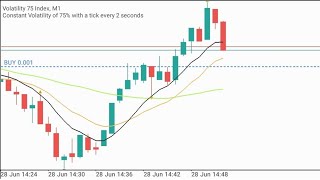 Volatility 75 Index 1 Minute Scalping Strategy and How I Trade it trading forex finance [upl. by Havens]