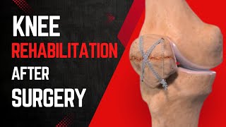 Knee Rehabilitation Exercises PostSurgery  Knee Strengthen Exercises [upl. by Hulen]