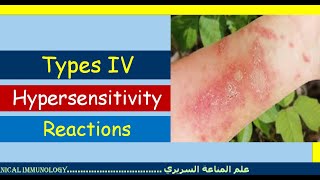 Lecture 7 Type IV Hypersensitivity Reaction [upl. by Judenberg]