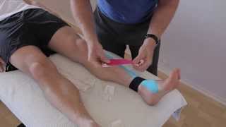 How to treat Anterior Shin Splints with Kinesiology taping [upl. by Isidore]