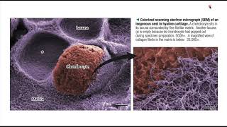 Histología Tejido Cartilaginoso [upl. by Atinus]