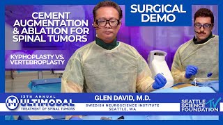 Cement Augmentation and Ablation for Spinal Tumors Kyphoplasty vs Vertebroplasty Glen David MD [upl. by Llerahs]