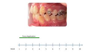 Physical properties of root cementum Part 27 Effect of lowlevel laser therapy on the repair of [upl. by Coppock788]