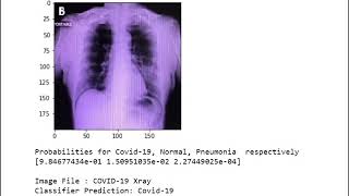 Covid 19 Classification Model  DenseNet121 [upl. by Enyleuqcaj]